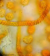 Attēlu rezultāti vaicājumam “Oligonema persimile”