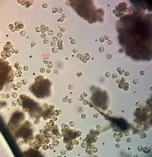 Attēlu rezultāti vaicājumam “Cribraria piriformis macro”