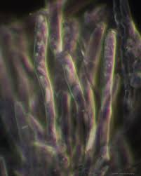 Attēlu rezultāti vaicājumam “Mollisia cinerea”