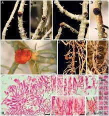 Attēlu rezultāti vaicājumam “Biatoropsis usnearum”