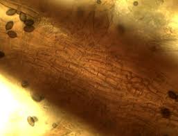 Attēlu rezultāti vaicājumam “Melanospora lagenaria”