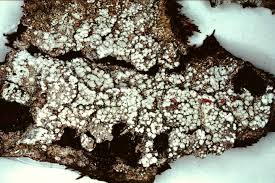 Attēlu rezultāti vaicājumam “Pertusaria amara”