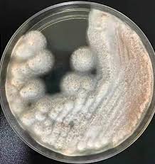 Attēlu rezultāti vaicājumam “Craterium aureonucleatum spores”