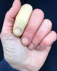 Znalezione obrazy dla zapytania palec