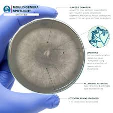 Attēlu rezultāti vaicājumam “Trichia botrytis spores”