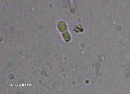 Attēlu rezultāti vaicājumam “Arthonia spadicea”