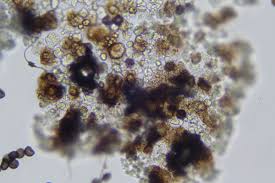 Attēlu rezultāti vaicājumam “Didymium proximum stalked”