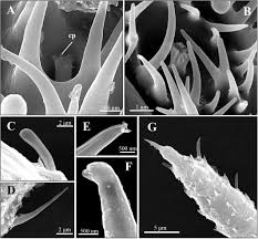 Attēlu rezultāti vaicājumam “Trichia alpina sessile”