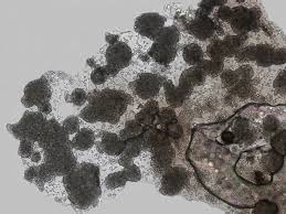 Attēlu rezultāti vaicājumam “Badhamia affinis var. microspora macro”