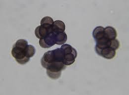 Attēlu rezultāti vaicājumam “Badhamia flavoglauca spores”