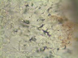 Attēlu rezultāti vaicājumam “Hymenoscyphus imberbis”