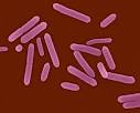 Clostridium <b>tetani</b>