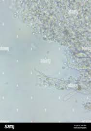 Attēlu rezultāti vaicājumam “Trechispora mollusca”