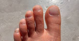 Znalezione obrazy dla zapytania palec