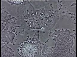 Attēlu rezultāti vaicājumam “Stemonitis flavogenita spores”