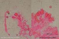 Attēlu rezultāti vaicājumam “Basidiodendron”
