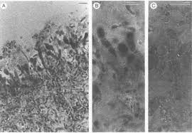 Attēlu rezultāti vaicājumam “Biatoropsis usnearum”