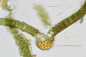 Attēlu rezultāti vaicājumam “Heterotrichia oerstedii (syn. Arcyria oerstedii) sessile”