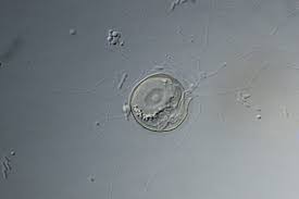 Attēlu rezultāti vaicājumam “Comatricha elegans var. microspora macro”