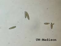 Attēlu rezultāti vaicājumam “Dianema nivale spores”