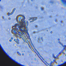 Attēlu rezultāti vaicājumam “Coleosporium sp.”