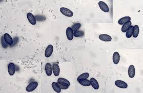 Attēlu rezultāti vaicājumam “Sowerbyella radiculata”