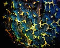 Attēlu rezultāti vaicājumam “Lignydium muscorum plasmodium”