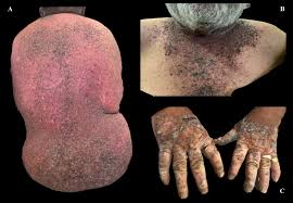 Attēlu rezultāti vaicājumam “Diderma subviridifuscum var. macrospora*”