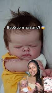 Image result for Nanismo Primordial