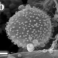 Attēlu rezultāti vaicājumam “Hemitrichia leiotricha spores”