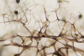 Attēlu rezultāti vaicājumam “Lamproderma ovoideum”