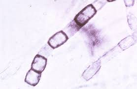Attēlu rezultāti vaicājumam “Diderma subviridifuscum spores”