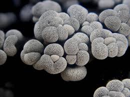 Attēlu rezultāti vaicājumam “Badhamia sp.”