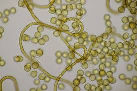 Attēlu rezultāti vaicājumam “Trichia botrytis spores”