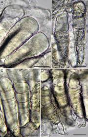 Attēlu rezultāti vaicājumam “Coleosporium sp.”