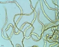 Attēlu rezultāti vaicājumam “Nostoc pruniforme cells”