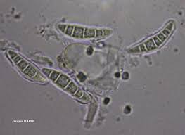 Attēlu rezultāti vaicājumam “Alyxoria varia”
