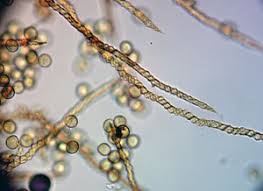 Attēlu rezultāti vaicājumam “Lycogala ustulatum macro”