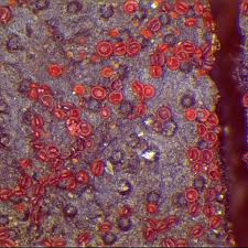 Attēlu rezultāti vaicājumam “Nectria episphaeria”