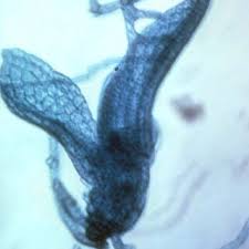 Attēlu rezultāti vaicājumam “Ephemerum serratum sporophyte”