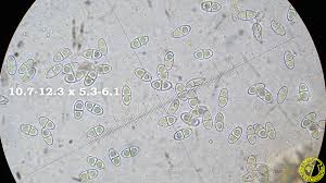 Attēlu rezultāti vaicājumam “Neonectria fuckeliana”