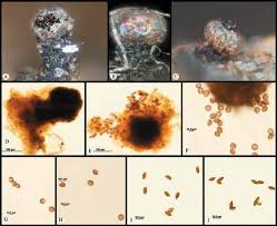 Attēlu rezultāti vaicājumam “Licea pygmaea spores”