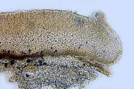 Attēlu rezultāti vaicājumam “Trapeliopsis flexuosa”
