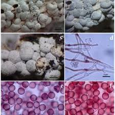 Attēlu rezultāti vaicājumam “Oligonema favogineum plasmodium”