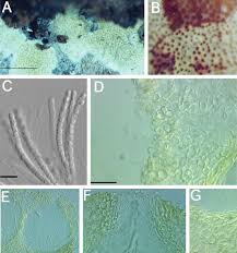 Attēlu rezultāti vaicājumam “Hypocrea pulvinata”