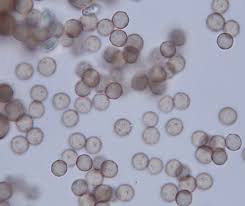 Attēlu rezultāti vaicājumam “Stemonitopsis typhina stalked”