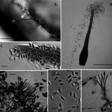 Attēlu rezultāti vaicājumam “Phleogena faginea sessile”