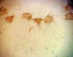 Attēlu rezultāti vaicājumam “Lycogala cf. oleocrystalliferum”