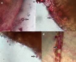 Attēlu rezultāti vaicājumam “Lycogala asperum”
