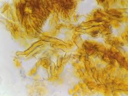 Attēlu rezultāti vaicājumam “Crustoderma dryinum”